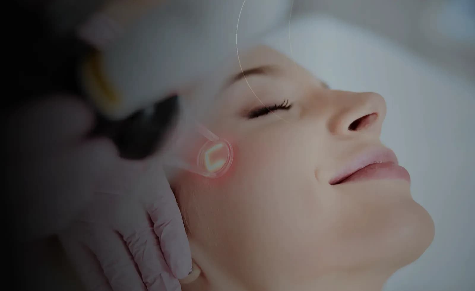 علاج ندبات حب الشباب في دبي at Endless Beauty Clinic Dubai