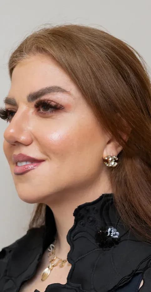 ليفت الوجه بفوتونا 7D بعد العلاج
