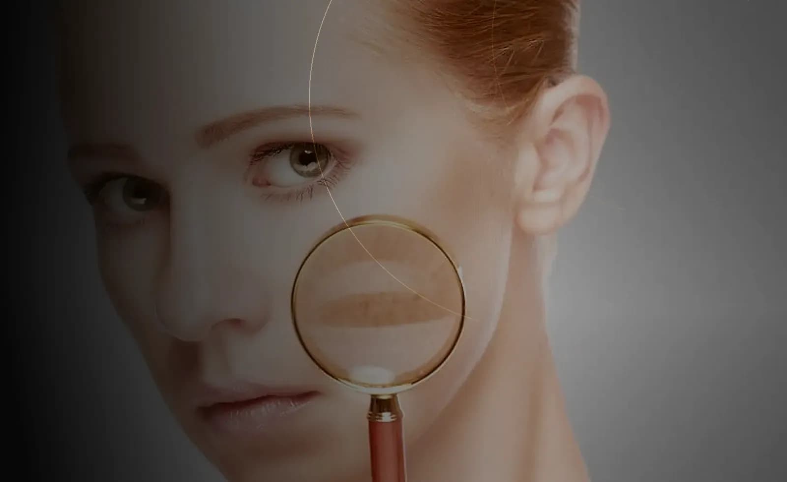 درمان پیگمانتاسیون و ملاسما در دبی at Endless Beauty Clinic Dubai