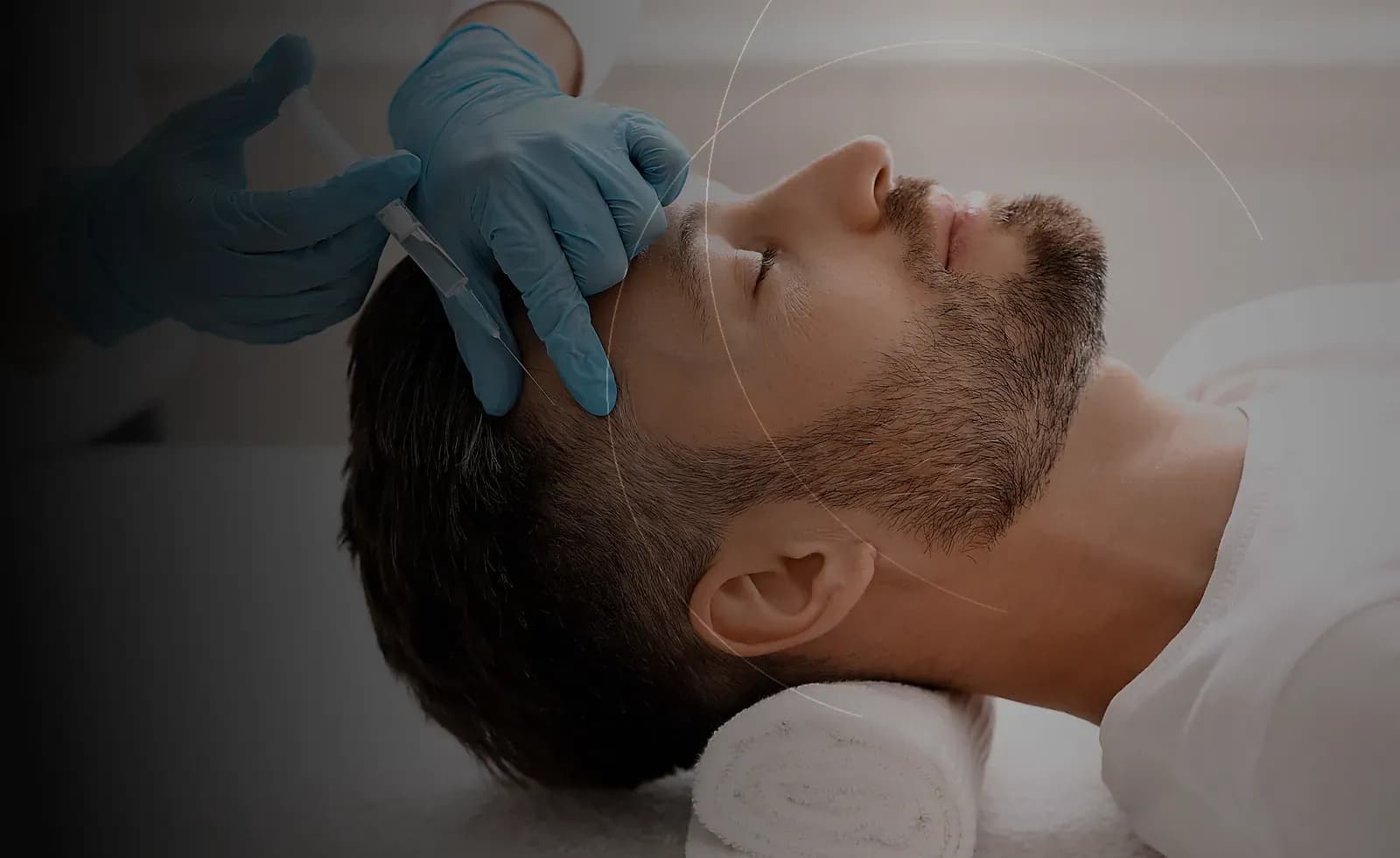 PRP Hair Restoration in Dubai at Endless Beauty Clinic Dubai