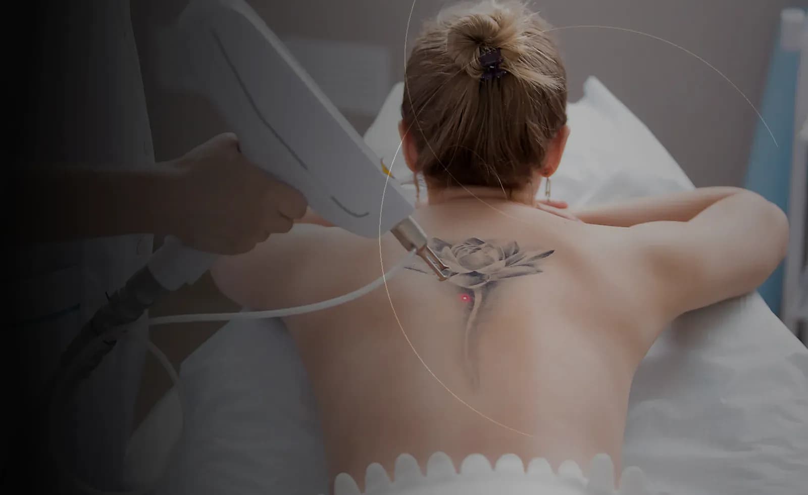 پاک کردن لیزر تاتو در دبی at Endless Beauty Clinic Dubai