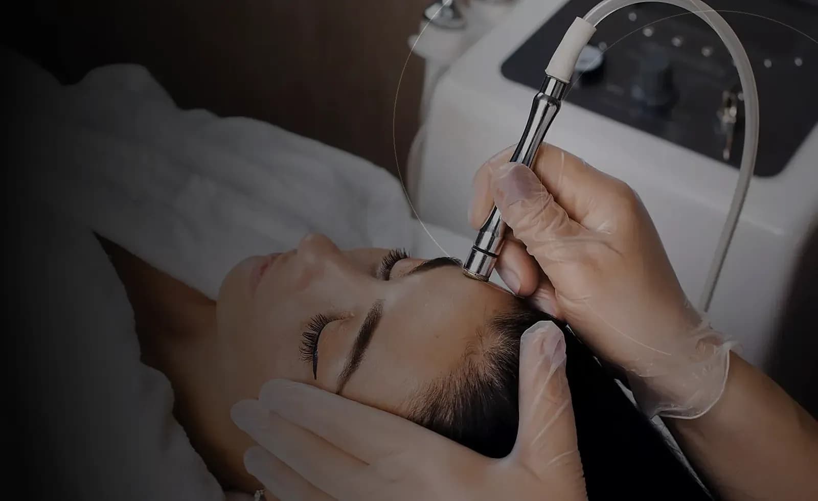 RF میکرونیدلینگ در دبی at Endless Beauty Clinic Dubai