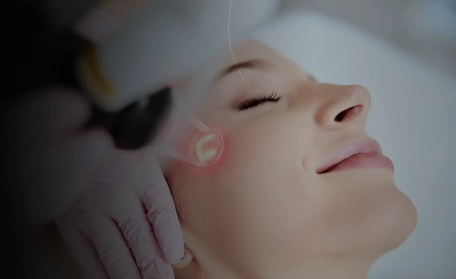 درمان استرچ مارک در دبی at Endless Beauty Clinic Dubai
