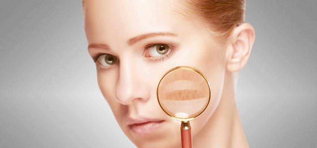 pigmentation treatment Dubai