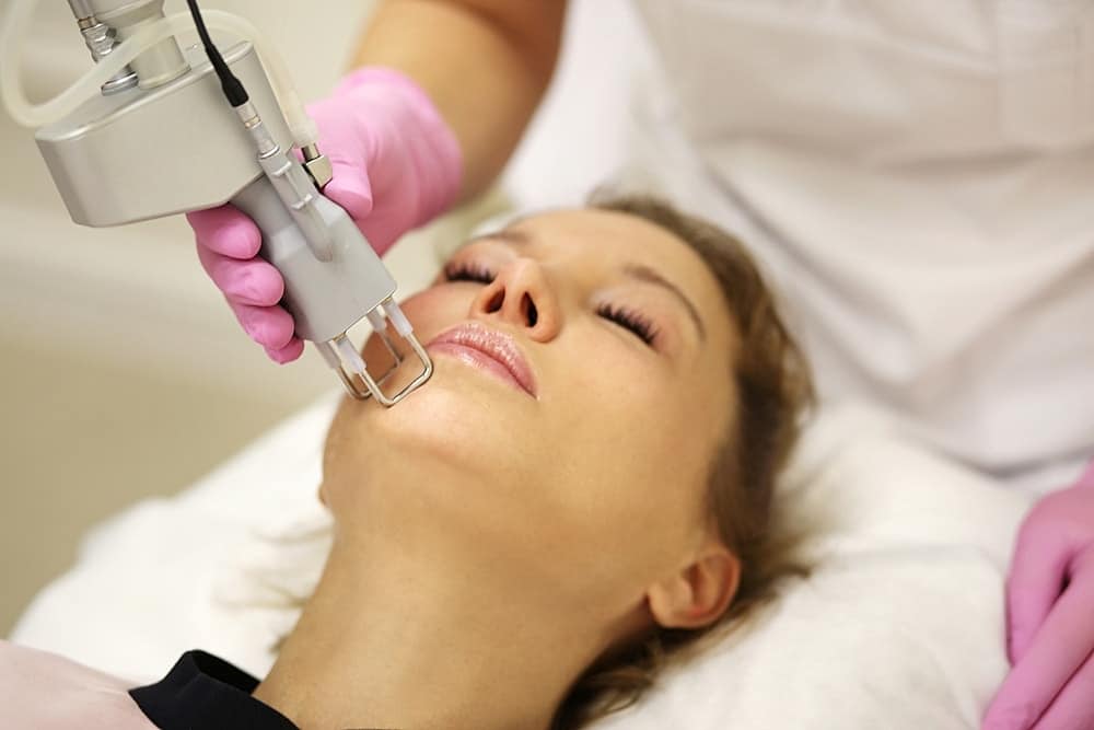 Laser Skin Resurfacing