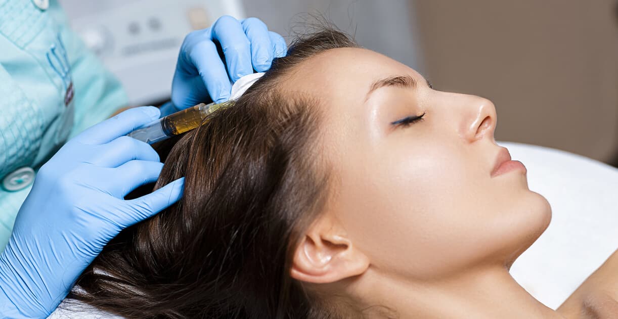 scalp mesotherapy in Dubai