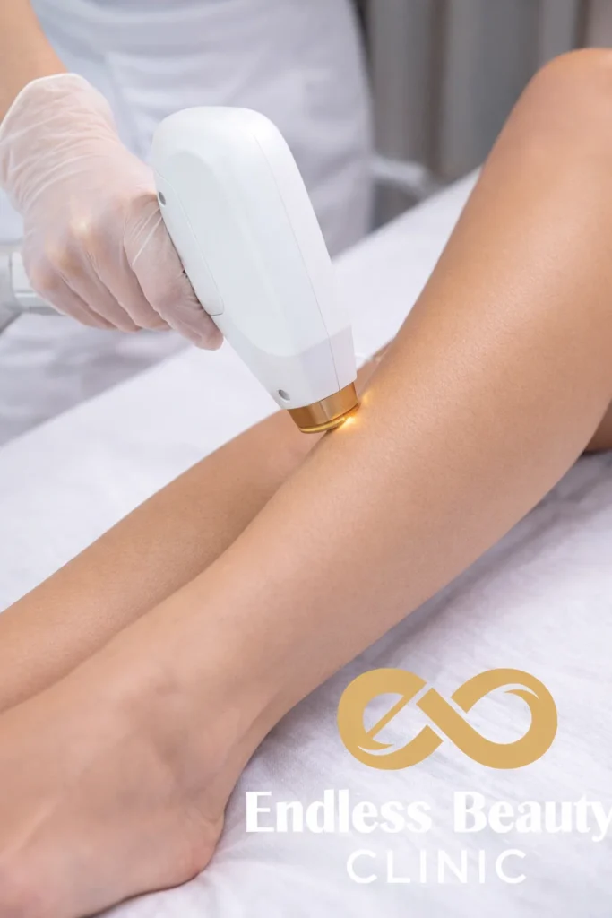 Looking for the best laser hair removal clinic in Dubai? Discover safe, effective treatments at Endless Beauty Clinic with advanced technology and expert specialists.